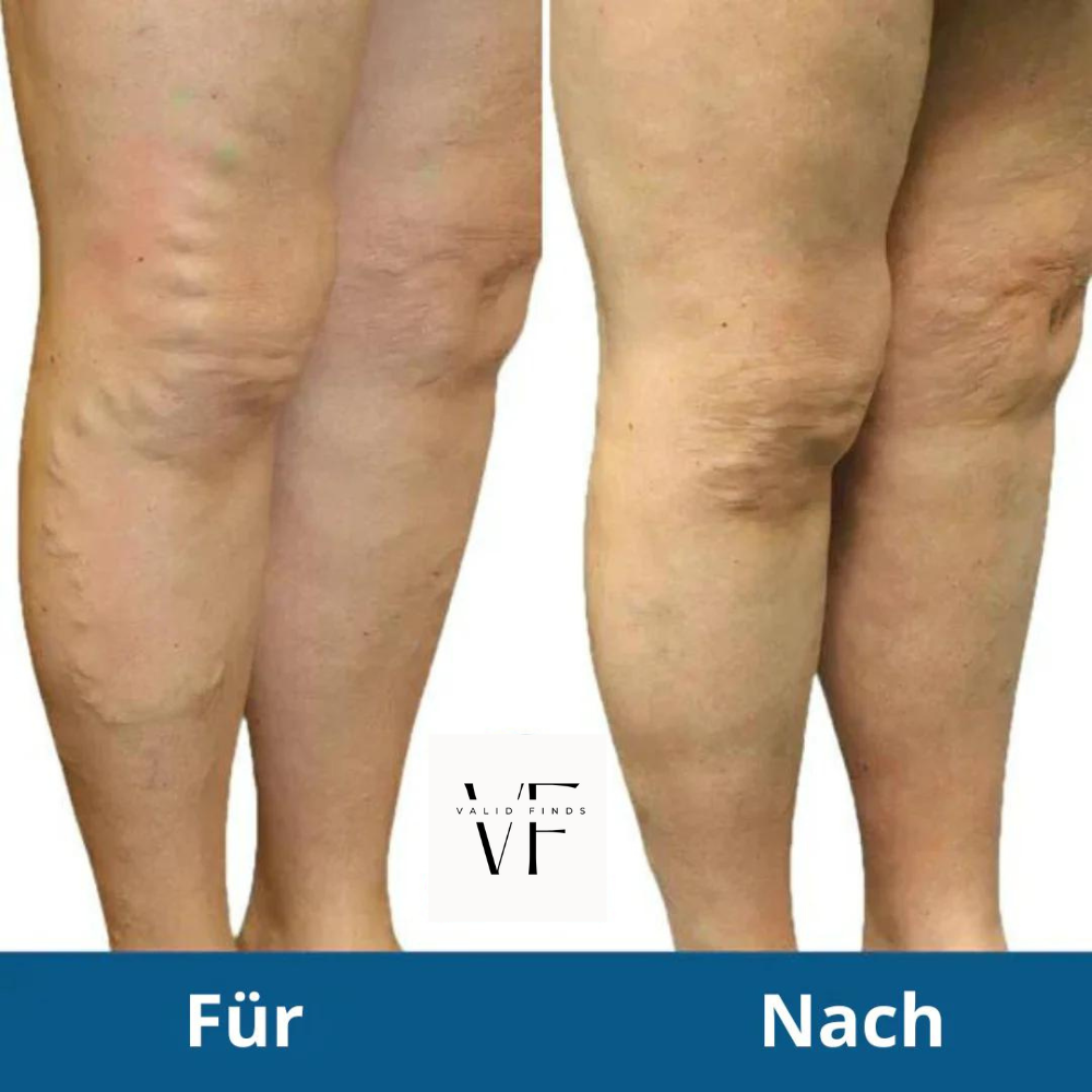 VF Premium FootPulse™ |  Schmerzprobleme behandeln und die Fettverbrennung ankurbeln!