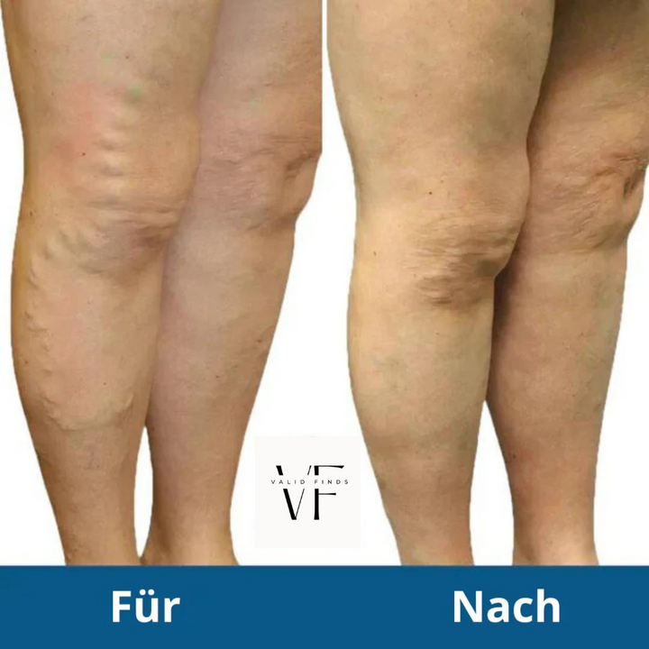 VF Premium FootPulse™ |  Schmerzprobleme behandeln und die Fettverbrennung ankurbeln!